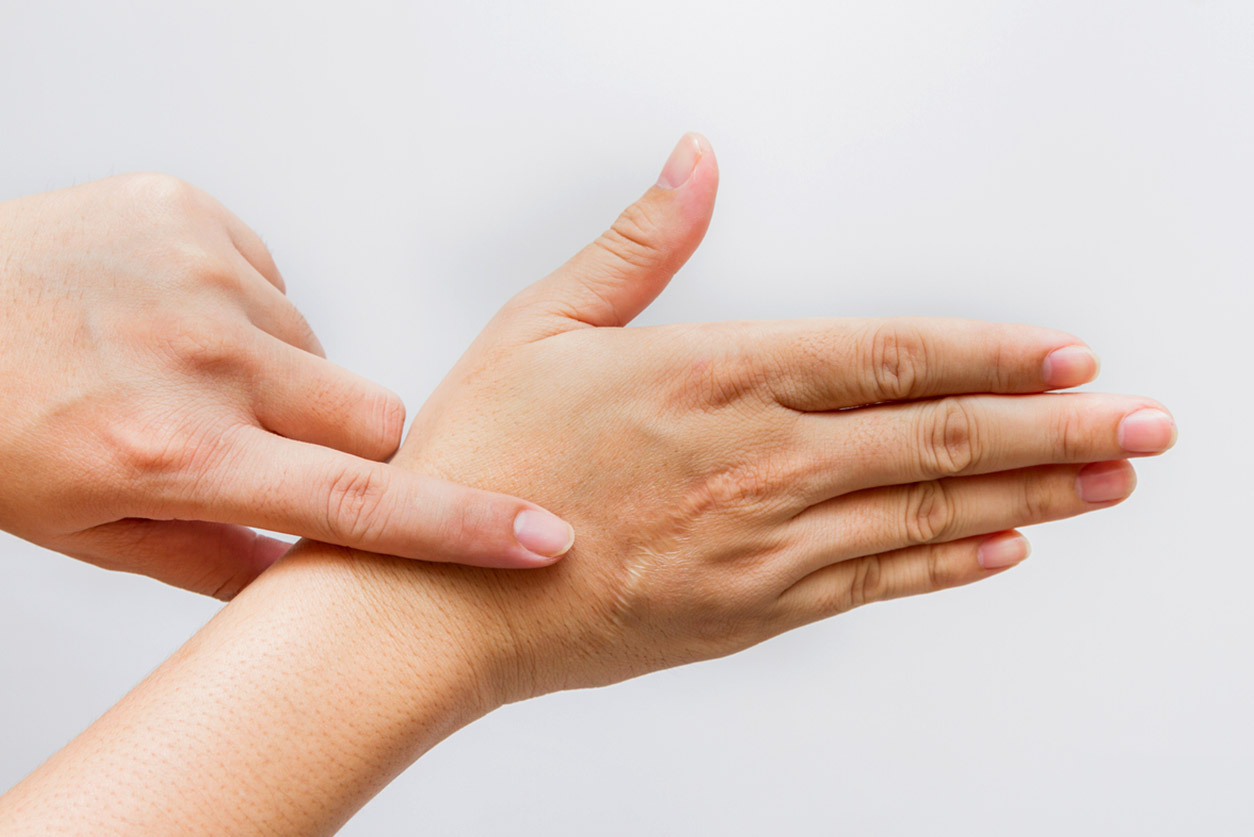 Are Scars Permanent? LIVING WITH SCARS